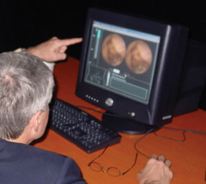 Image of doctor examining intestinal microscoping on a computer