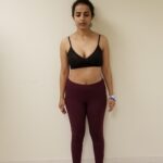 Front image of AA after Orbera procedure