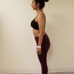 Left view of AA after Orbera procedure