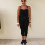 Front view of AR after reshaping procedure