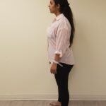 Side image of Amal before reshape procedure