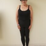 Front view of Greisen after reshaping procedure