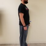 Right side image of man after reshape procedure