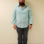 Front image of man standing before reshape procedure