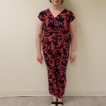 Front image of woman before reshape procedure