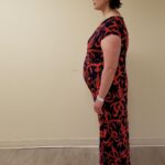 Left view of woman in red patterned dress before reshape procedure