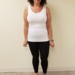 Front view of JJ after reshape procedure