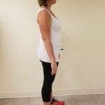 Side Image of JM after reshape procedure