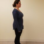 Side view of woman in blue before reshape procedure