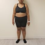 Front view image of woman standing after reshape procedure