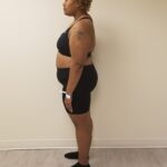 Left side image of woman standing after reshape procedure