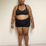 Front view of woman standing before reshape procedure