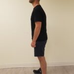 Left view of MW after reshape procedure