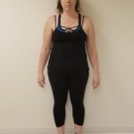 Front Image of JM before reshape procedure