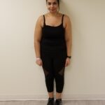 Front view of woman in black before her reshaping procedure