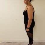 Right view of Roman before reshape procedure