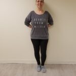 Front image of Sessa after reshape procedure