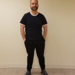 Front view of willmore before reshape procedure