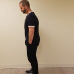 Left view of man slightly bending before reshape procedure