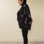 Side profile of SG before reshape procedure