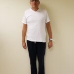 Front image of TP after reshape procedure