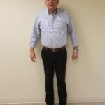 Front image of TP before reshape procedure