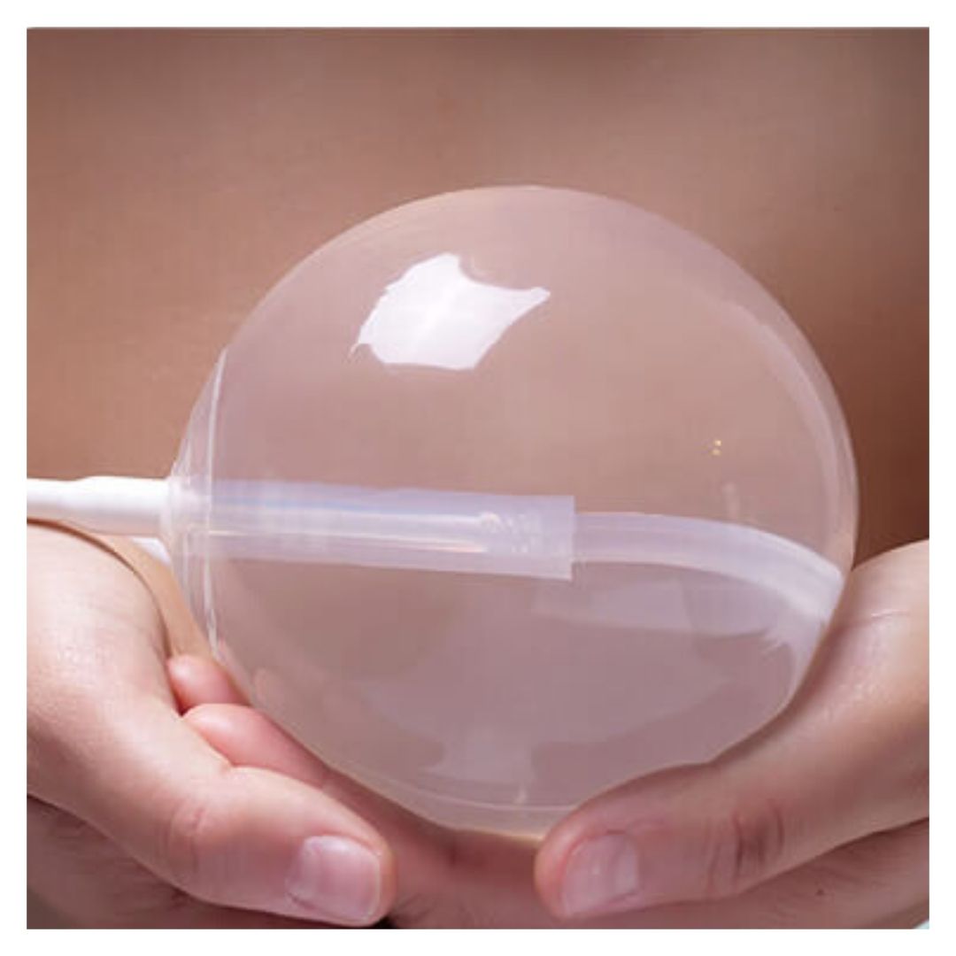 gastric balloon