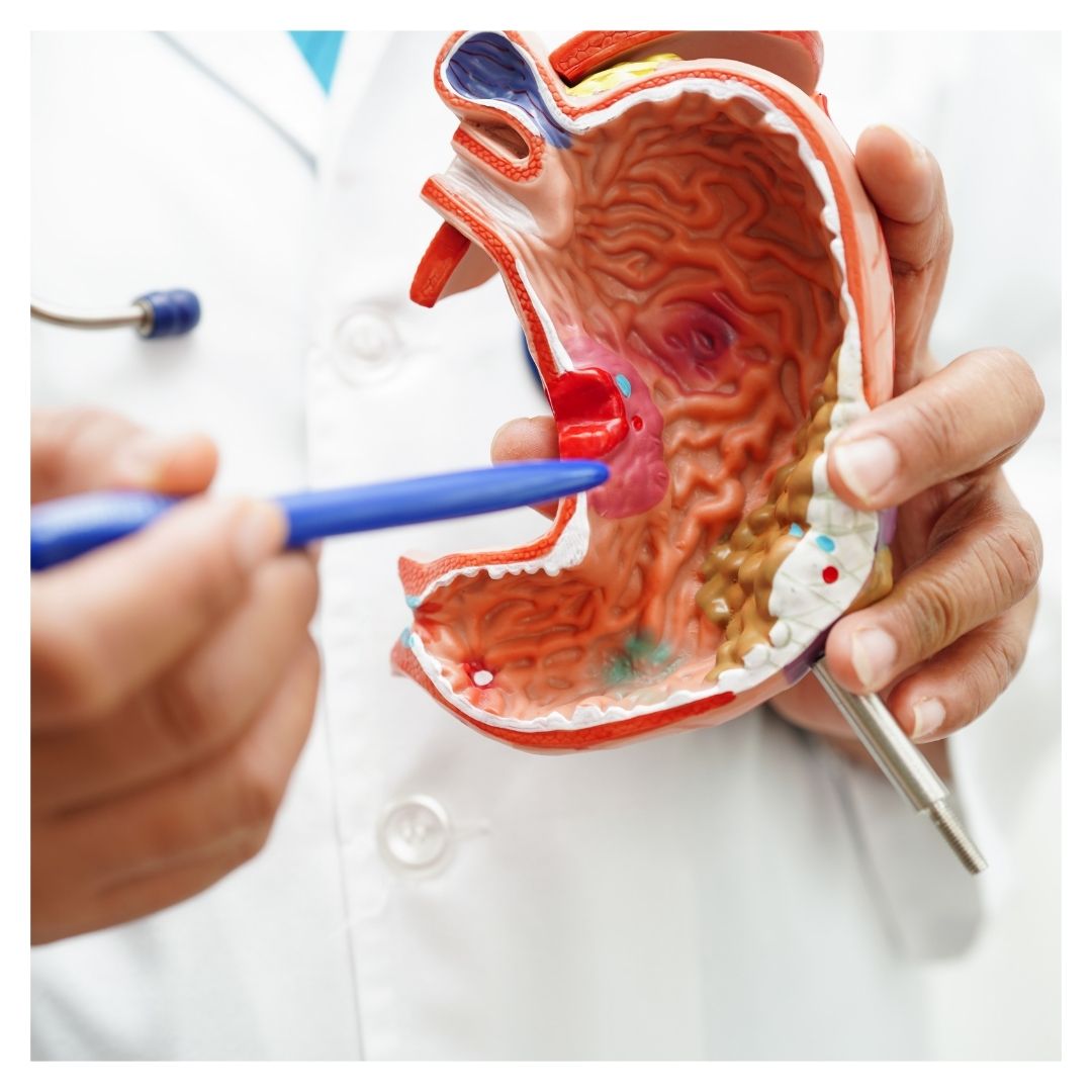 doctor using a stomach model